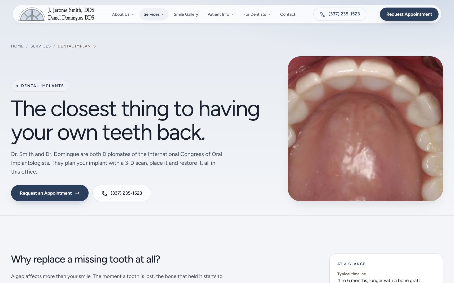 The dental implants service page at 1440x900, one of twelve service pages carried across from the original site.