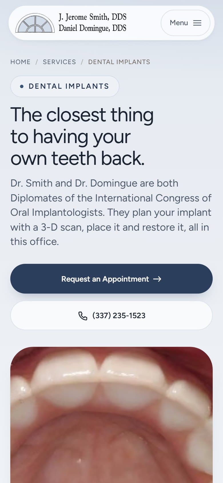 The dental implants service page on a 390x844 phone screen.